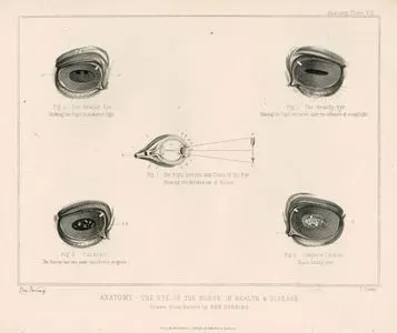 Sağlıklı Ve Hastalıklı At Gözünün Anatomik Yapısı, Plate VII.