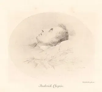 Frederic Chopin 1849 Yılında Ölüm Döşeğinde